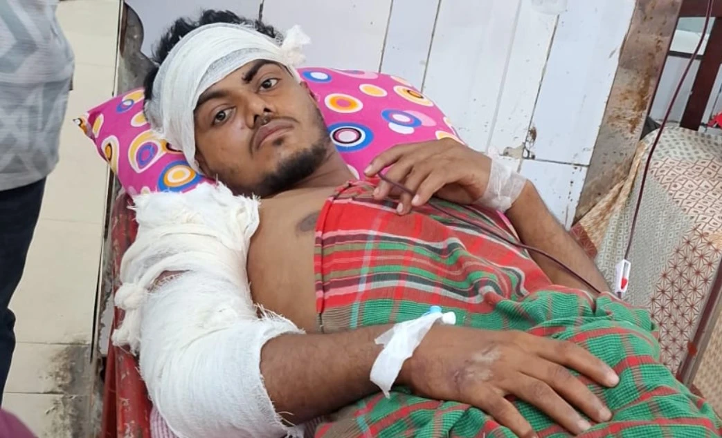 মতলব উত্তরে প্রকাশ্যে কুপিয়ে যুবককে হত্যাচেষ্টা, পা হারানোর শঙ্কায় মাসুম