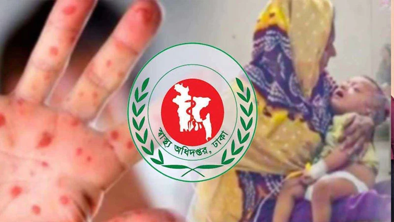 হামের উপসর্গে আরও ৩ শিশুর মৃত্যু, শনাক্ত ৯০৫