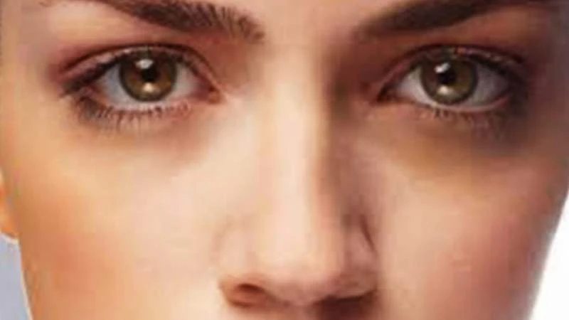 চোখের নিচে কালি, দূর করবেন যেভাবে