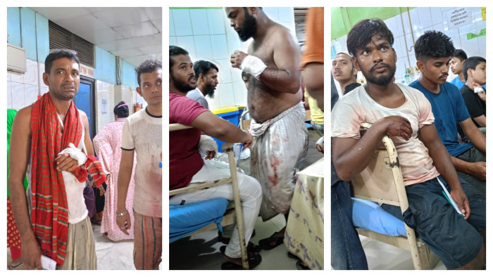 কোরবানি দিতে গিয়ে আহত ১৫৪ জন ঢাকা মেডিকেলে
